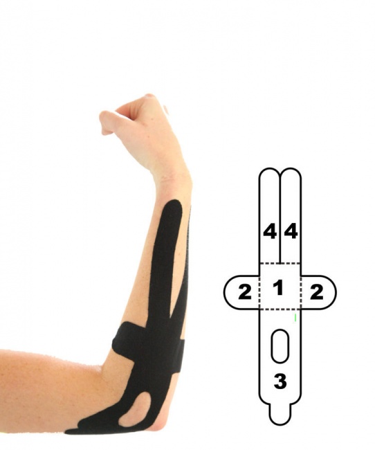 Kindmax Kinesiology Tape Elbow Support - Black